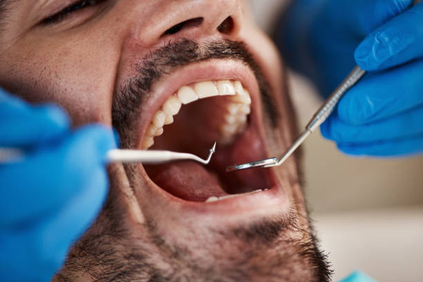 Best Broken or Cracked Tooth Emergency Dentist in Virginia Gardens, FL